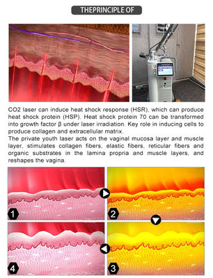 Fractional CO2 Laser For Stretch Marks Removal Laser Machine Scar Removal Vagina Tighten Laser Fractional