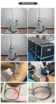 Co2 Fractional Laser Machine Germany Diode Laser Hot Selling Wrinkle Acne Scar Removal