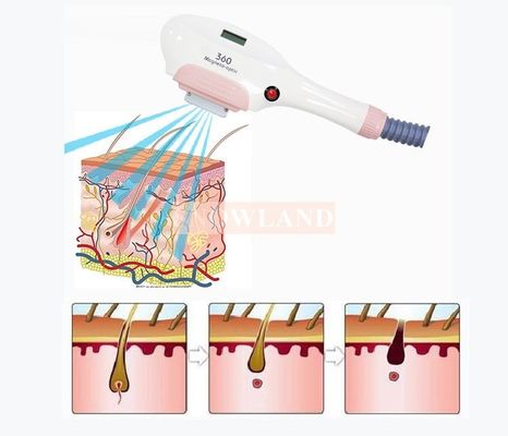 360 Magneto-optical ipl shr hair removal beauty machine
