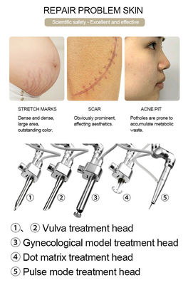 Fractional CO2 Laser For Stretch Marks Removal Laser Machine Scar Removal Vagina Tighten Laser Fractional