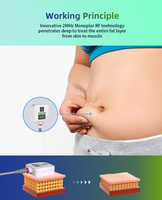 2023 New Arrival Portable TruSculpt ID Trushape ID Body Sculpting Fat Dissolving Fat Burning Weight Loss Machine
