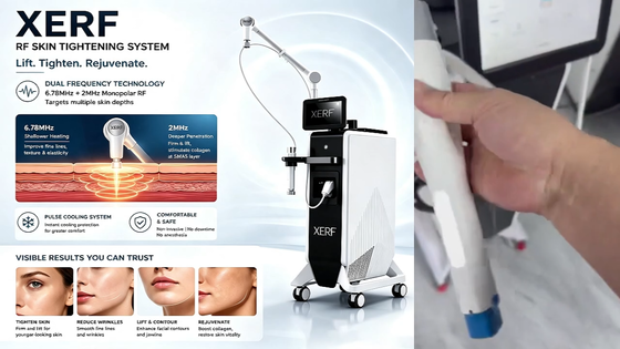 Aesthetic Clinic XERF Dual Frequency 6.78MHz Painless Skin Tightening SMAS Face Lift Collagen Boost OEM